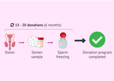 Donor Sperm Freezing